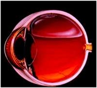 pnomatik-retinopekside