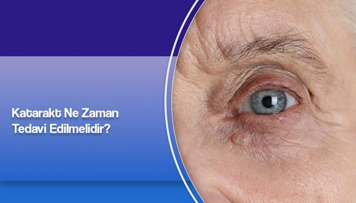 katarakt-ne-zaman-tedavi-edilmelidir-prof-dr-ates-yanyali