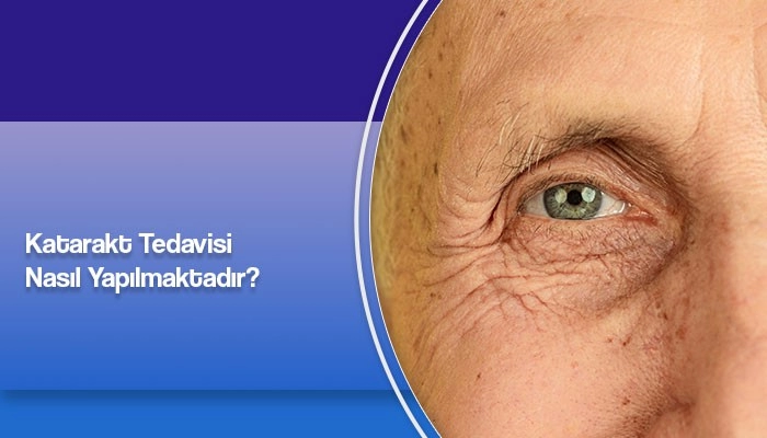 katarakt-tedavisi-nasil-yapilmaktadir-prof-dr-ates-yanyali