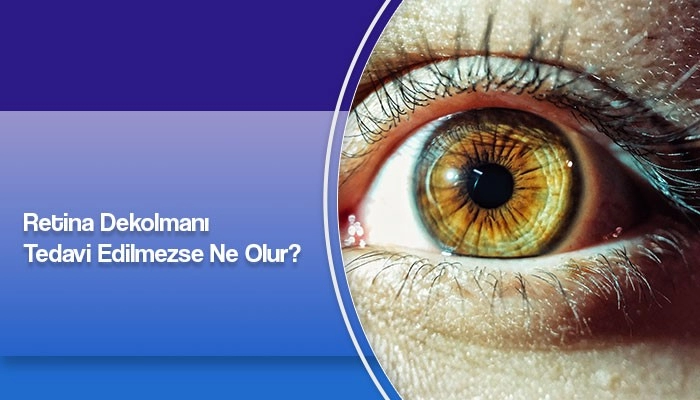 retina-dekolmani-tedavi-edilmezse-ne-olur-prof-dr-ates-yanyali