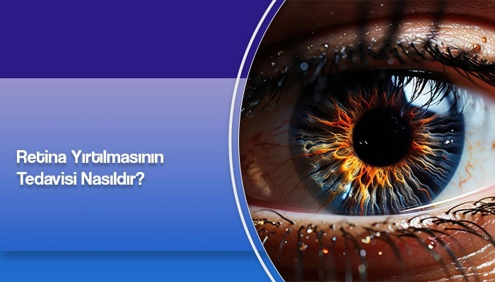 retina-yirtilmasinin-tedavisi-nasildir-prof-dr-ates-yanyali