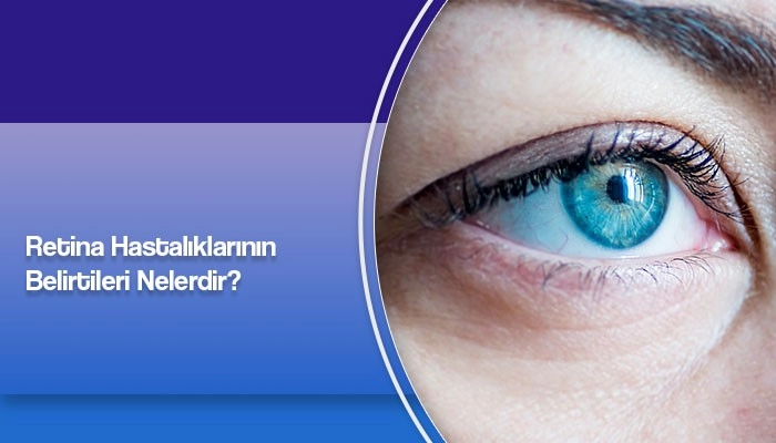 retina-hastaliklarinin-belirtileri-nelerdir-prof-dr-ates-yanyali