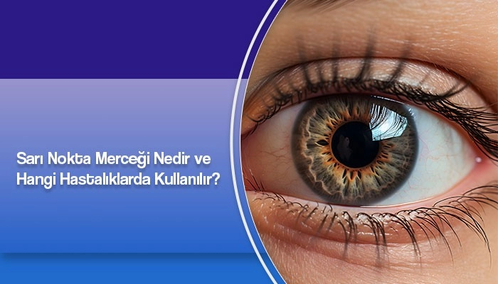 sari-nokta-mercegi-nedir-ve-hangi-hastaliklarda-kullanilir-prof-dr-ates-yanyali