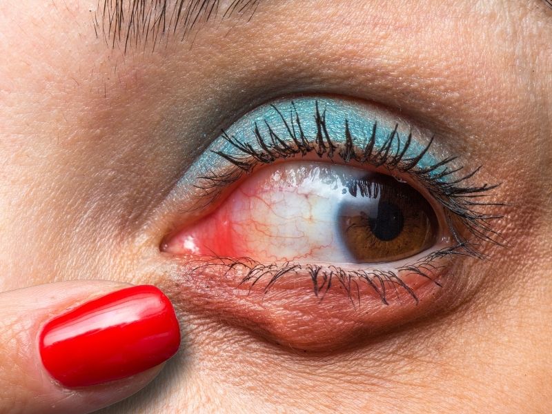 salazyon-belirtileri